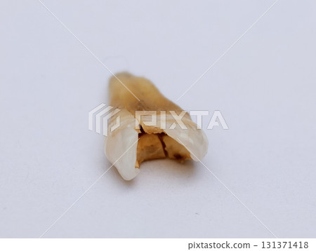 Pulled out cracked and damaged tooth, second premolar on a white background 131371418