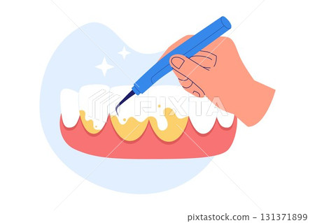 Illustration of Plaque Removal and Dental Scaling 131371899