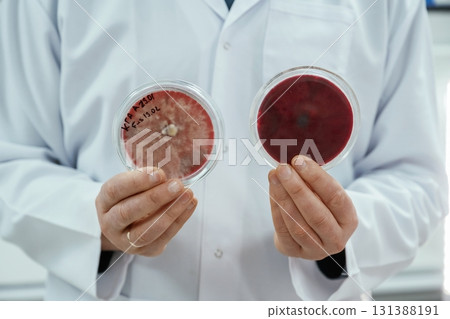 Lab worker is holding containers with trichoderma and sclerotinia Lab worker is holding containers with trichoderma and sclerotinia 131388191