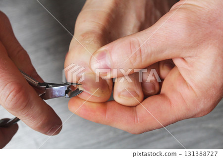 Nail trimming with nail clippers. Toenail care 131388727