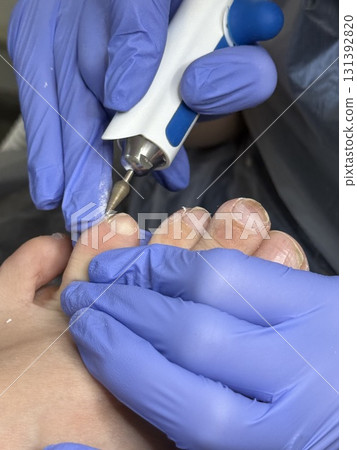 A professional podologist cleans the skin under the big toe nail of a female client with a special tool. Foot care A professional podologist cleans the skin under the big toe nail of a female client with a special tool. Foot care 131392820