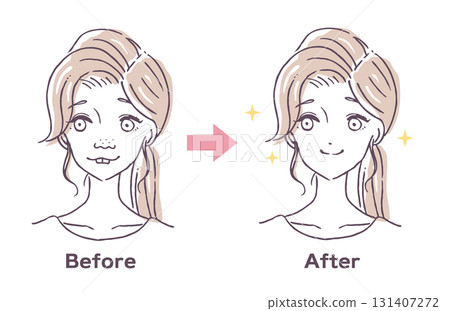 整容手術前後向量插圖素材 131407272