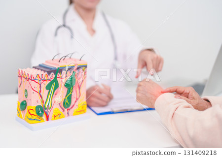 woman Patient consultation Dermatologist with anatomy of skin and hair. Skin disease and Hair loss, Systemic Lupus Erythematosus or SLE, world lupus day, May Melanoma and Skin Cancer Awareness month woman Patient consultation Dermatologist with anatomy of skin and hair. Skin disease and Hair loss, Systemic Lupus Erythematosus or SLE, world lupus day, May Melanoma and Skin Cancer Awareness month 131409218