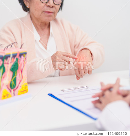 woman Patient consultation Dermatologist with anatomy of skin and hair. Skin disease and Hair loss, Systemic Lupus Erythematosus or SLE, world lupus day, May Melanoma and Skin Cancer Awareness month woman Patient consultation Dermatologist with anatomy of skin and hair. Skin disease and Hair loss, Systemic Lupus Erythematosus or SLE, world lupus day, May Melanoma and Skin Cancer Awareness month 131409230