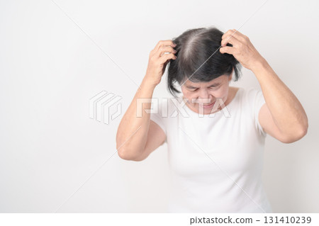 Elderly woman having itchy Scalp and Head hair, Dandruff, Dry Scalp, Skin Allergy Seborrheic dermatitis. Dermatology, Leprosy day, Systemic lupus erythematosus, SLE, Psoriasis and Atopic Eczema rash Elderly woman having itchy Scalp and Head hair, Dandruff, Dry Scalp, Skin Allergy Seborrheic dermatitis. Dermatology, Leprosy day, Systemic lupus erythematosus, SLE, Psoriasis and Atopic Eczema rash 131410239