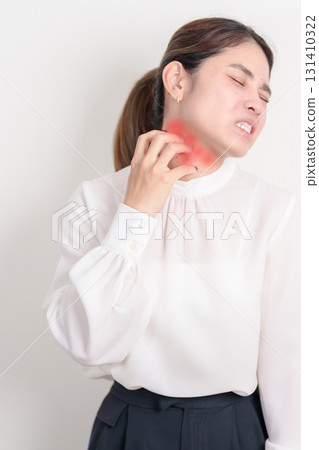 Business woman itching Neck and body scratching for Skin Allergy from insect bite and food dermatitis. Dermatology, Leprosy day, Systemic lupus erythematosus, Psoriasis, Urticaria and rash Eczema 131410322