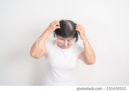 Elderly woman having itchy Scalp and Head hair, Dandruff, Dry Scalp, Skin Allergy Seborrheic dermatitis. Dermatology, Leprosy day, Systemic lupus erythematosus, SLE, Psoriasis and Atopic Eczema rash 131410522