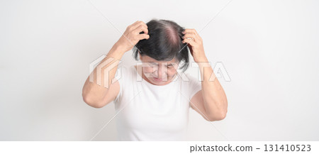 Elderly woman having itchy Scalp and Head hair, Dandruff, Dry Scalp, Skin Allergy Seborrheic dermatitis. Dermatology, Leprosy day, Systemic lupus erythematosus, SLE, Psoriasis and Atopic Eczema rash Elderly woman having itchy Scalp and Head hair, Dandruff, Dry Scalp, Skin Allergy Seborrheic dermatitis. Dermatology, Leprosy day, Systemic lupus erythematosus, SLE, Psoriasis and Atopic Eczema rash 131410523