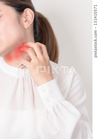 Business woman itching Neck and body scratching for Skin Allergy from insect bite and food dermatitis. Dermatology, Leprosy day, Systemic lupus erythematosus, Psoriasis, Urticaria and rash Eczema Business woman itching Neck and body scratching for Skin Allergy from insect bite and food dermatitis. Dermatology, Leprosy day, Systemic lupus erythematosus, Psoriasis, Urticaria and rash Eczema 131410571
