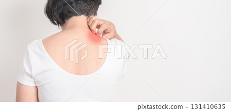 Elderly woman itching Neck and body scratching for Skin Allergy from insect bite and food dermatitis. Dermatology, Leprosy day, Systemic lupus erythematosus, Psoriasis, Urticaria and rash Eczema 131410635