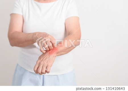 Elderly woman itching arm and body scratching for Skin Allergy from insect bite and food dermatitis. Dermatology, Leprosy day, Systemic lupus erythematosus, Psoriasis, Urticaria and rash Eczema Elderly woman itching arm and body scratching for Skin Allergy from insect bite and food dermatitis. Dermatology, Leprosy day, Systemic lupus erythematosus, Psoriasis, Urticaria and rash Eczema 131410643