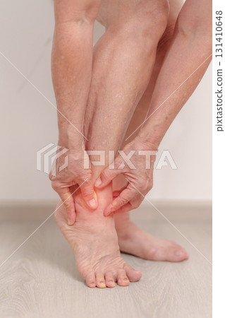 Elderly woman having leg pain due to Ankle Sprains or Achilles Tendonitis and Shin Splints ache. injury, hyperuricemia disease, Gout,Senior Health care and medical treatment concepts Elderly woman having leg pain due to Ankle Sprains or Achilles Tendonitis and Shin Splints ache. injury, hyperuricemia disease, Gout,Senior Health care and medical treatment concepts 131410648