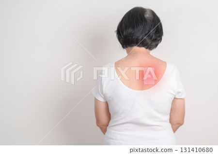 Business woman having back ache with Medicated pain relief patch plaster for Back Muscle Strain, Scapular Muscle Tightness, Piriformis Syndrome, Osteoporosis, Spinal Compression and Health care 131410680