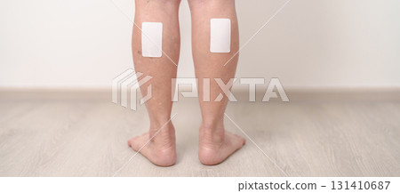 Elderly woman having Calf pain with Medicated pain relief patch plaster for concepts of Calf Muscle Strain, muscle pull, Leg Cramp, Sprain, aches, Varicose Veins, Deep Vein and world Thrombosis day Elderly woman having Calf pain with Medicated pain relief patch plaster for concepts of Calf Muscle Strain, muscle pull, Leg Cramp, Sprain, aches, Varicose Veins, Deep Vein and world Thrombosis day 131410687