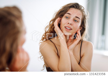 Skin problem. Natural beauty. Medical care and treatment concept. 131423356