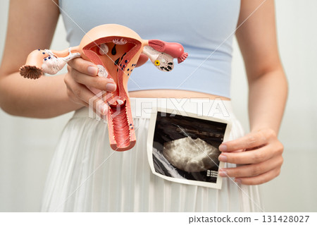 Uterus ultrasound, Asian woman holding human anatomy model. 131428027
