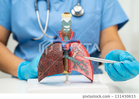 Cirrhosis, Liver cancer, fatty liver, Asian woman with liver human anatomy model. 131430633