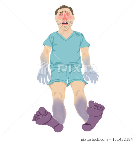 感染性休克患者的全身性圖示（發紺和潮紅） 131432194