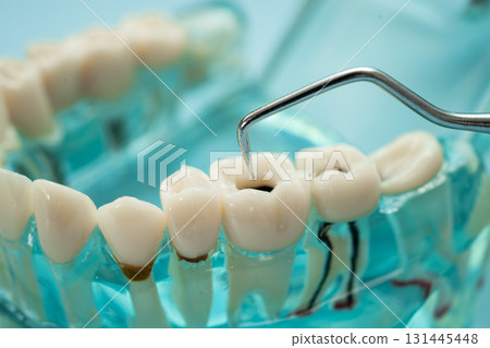 Dental teeth model with dentist tool for dentistry. 131445448