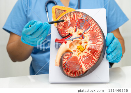 Chronic kidney disease, doctor with model for treatment urinary system, urology, Estimated glomerular filtration rate eGFR. Chronic kidney disease, doctor with model for treatment urinary system, urology, Estimated glomerular filtration rate eGFR. 131449356