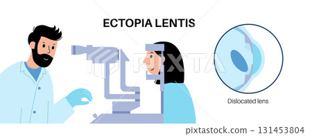 Ectopia lentis disease 131453804