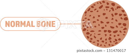 Illustration of healthy bone matter and cell structure. This is a diagram to explain. 131470017