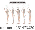 Straight neck (smartphone neck) Head tilt angle and neck strain 131473820