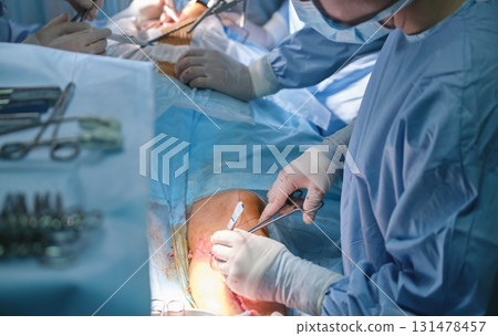 Surgery doctor operating a patient in surgical room. Healthcare and medical aid concept 131478457