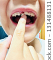 Front teeth that are about to fall out 131488131