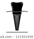 Dental implant, silhouette icon. Screw prosthesis, Illustration of dental implantation,orthodontic dental implantation 131501456