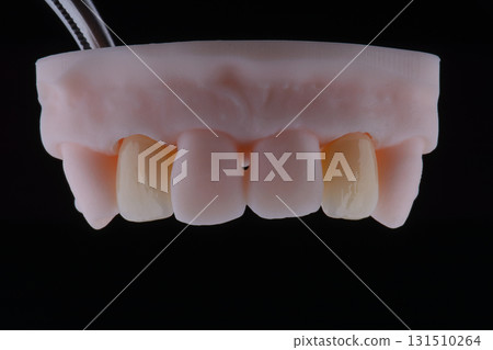 High-quality dental single crowns made of zirconium for fixation to the frontal teeth of upper jaw. 131510264