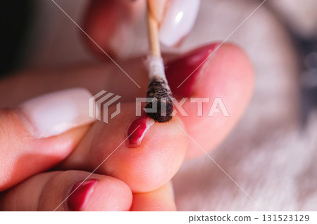 Nail care procedure with red polish on toes during a pampering session in a cozy setting. Treating a festering nail with an iodine swab Nail care procedure with red polish on toes during a pampering session in a cozy setting. Treating a festering nail with an iodine swab 131523129