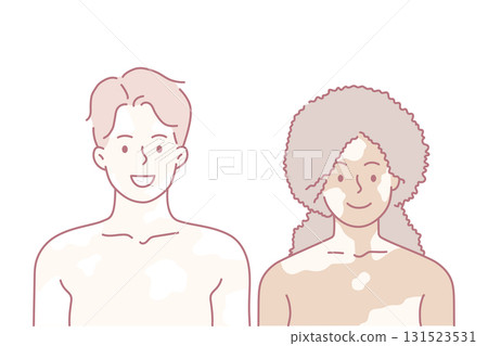 Vitiligo and mixed race love concept Vitiligo and mixed race love concept 131523531