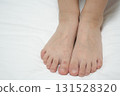 A child's hands and feet with a rash from hand, foot, and mouth disease (medical/infectious disease image) 131528320