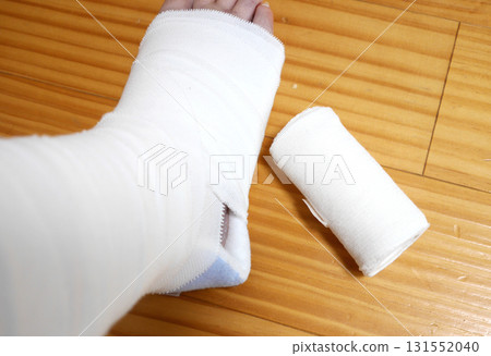 right leg fracture right leg fracture 131552040