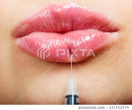 Closeup shot  of beautiful female lips and syringe with filler 131552574