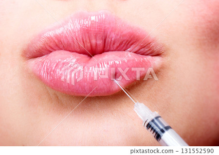 Closeup shot of beautiful young woman receiving filler injection in lips, beauty treatment concept 131552590