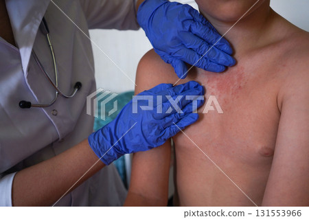 The physician is looking at the boy's skin for possible infections. 131553966