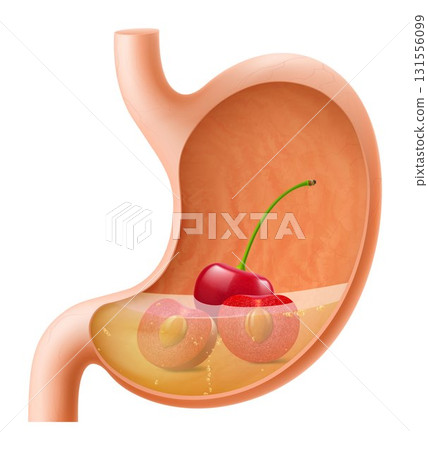 Human Stomach with cherries. The stomach digests cherries. A stomach filled with healthy and wholesome food. Proper nutrition. Realistic 3d Vector illustration. Food digestion process illustration 131556099