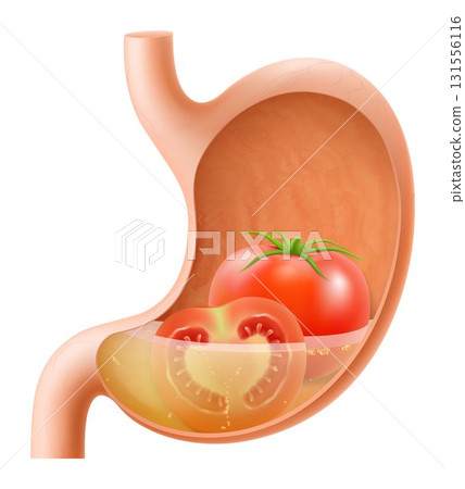 Human Stomach with tomato. The stomach digests tomatoes. A stomach filled with healthy and wholesome food. Proper nutrition. Realistic 3d Vector illustration. Food digestion process illustration Human Stomach with tomato. The stomach digests tomatoes. A stomach filled with healthy and wholesome food. Proper nutrition. Realistic 3d Vector illustration. Food digestion process illustration 131556116
