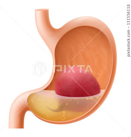Human Stomach with beetroot. The stomach digests beets. A stomach filled with healthy and wholesome food. Proper nutrition. Realistic 3d Vector illustration. Food digestion process illustration 131556118