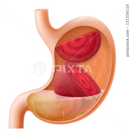 Human Stomach with beetroot. The stomach digests beets. A stomach filled with healthy and wholesome food. Proper nutrition. Realistic 3d Vector illustration. Food digestion process illustration Human Stomach with beetroot. The stomach digests beets. A stomach filled with healthy and wholesome food. Proper nutrition. Realistic 3d Vector illustration. Food digestion process illustration 131556119