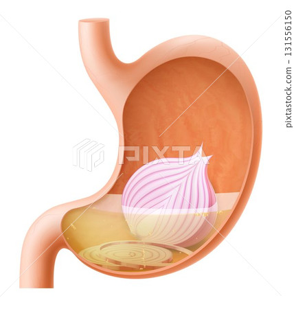 Human Stomach with onion. The stomach digests red onion. A stomach filled with healthy and wholesome food. Proper nutrition. Realistic 3d Vector illustration. Food digestion process illustration 131556150