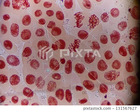 洋蔥染色體的觀察 131567627