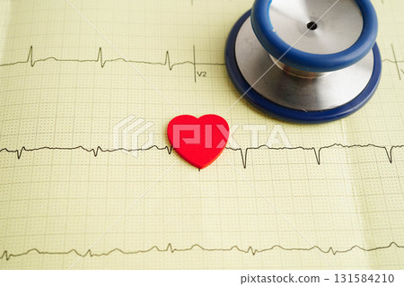 Stethoscope on electrocardiogram (ECG), heart wave, heart attack, cardiogram report. 131584210