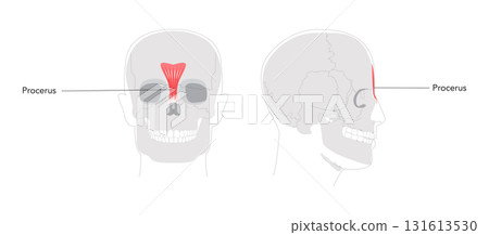 Procerus - Nasal muscle shown in anatomy diagram, responsible for drawing the skin between the eyebrows downward, 131613530
