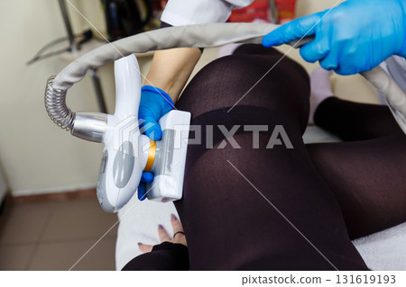 LPG massage procedure for removing subcutaneous fat from a young woman. 131619193