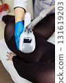 LPG massage procedure for removing subcutaneous fat from a young woman. 131619203