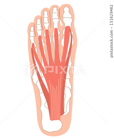 Plantar fascia, plantar aponeurosis, plantar fasciitis, foot muscles 131629462