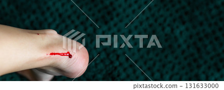 a woman's leg or foot showing a small wound and blood near the heel, resulting from a shaving cut. minor wound copy space first aid. razor safety banner image a woman's leg or foot showing a small wound and blood near the heel, resulting from a shaving cut. minor wound copy space first aid. razor safety banner image 131633000